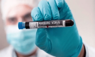 Chủ động giám sát, phát hiện và kiểm soát bệnh do virus Marburg