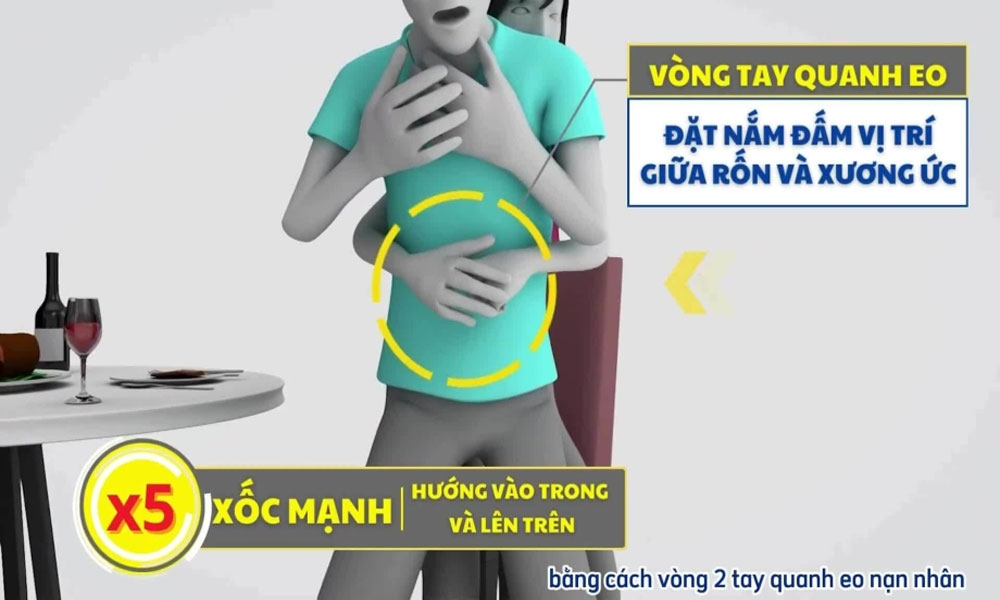  Cách sơ cứu người hóc dị vật